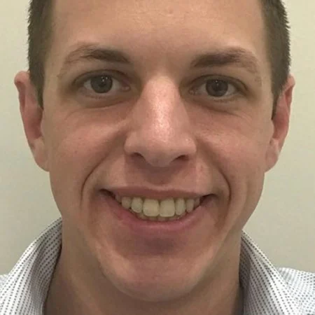 Homem depois do tratamento Invisalign, com dentes alinhados — resultado do Dr. Saulo Lima em São José dos Campos